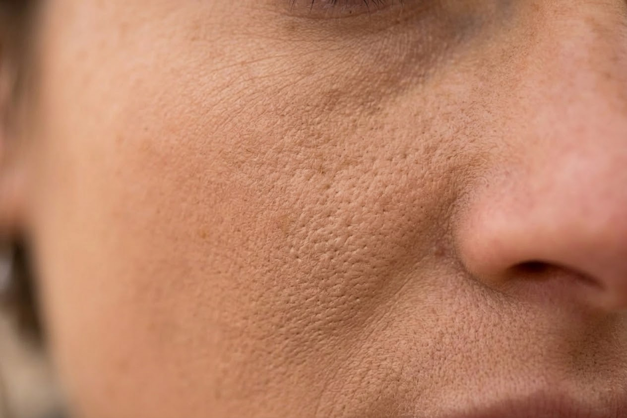 Mekana, krupna fotografija prirodne teksture kože na obrazu, na kojoj se vidi suptilna zapušenost pora pod slojem teškog pudera.